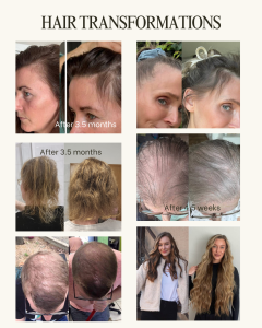 Hair growth transformations