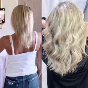 Hair Loss Treatment Online Consultation