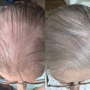 Thicker stronger hair Perth